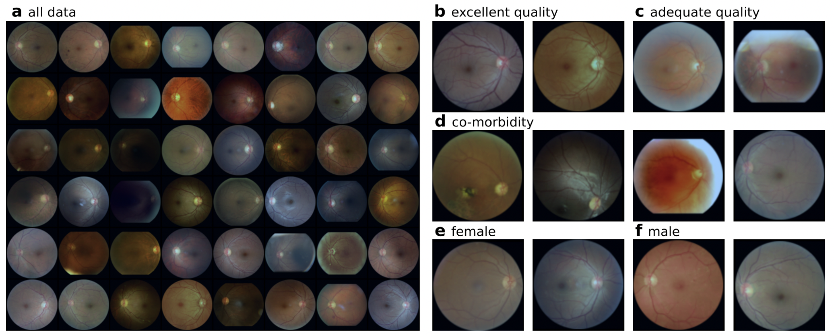 Deep Hypothesis Tests Detect Clinically Relevant Subgroup Shifts in Medical Images